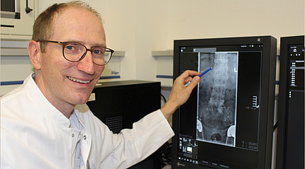 Ein Arzt zeigt mit einem Stift auf ein Röntgenbild. Auf dem Bild ist eine Wirbelsäule zu erkennen